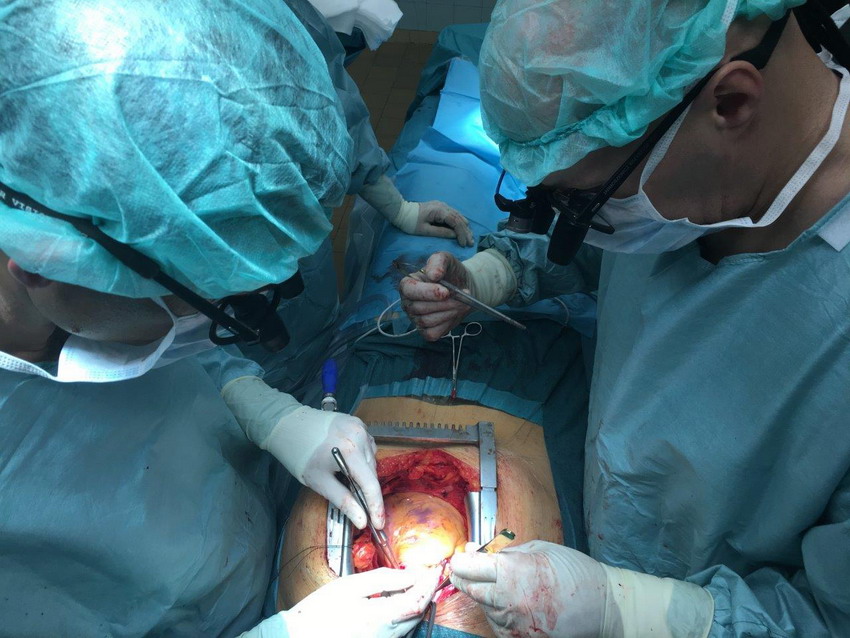 W Wejherowie będą wspierać kardiochirurgię. Powstała nowa fundacja, która kupi sprzęt i będzie promować zdrowy tryb życia