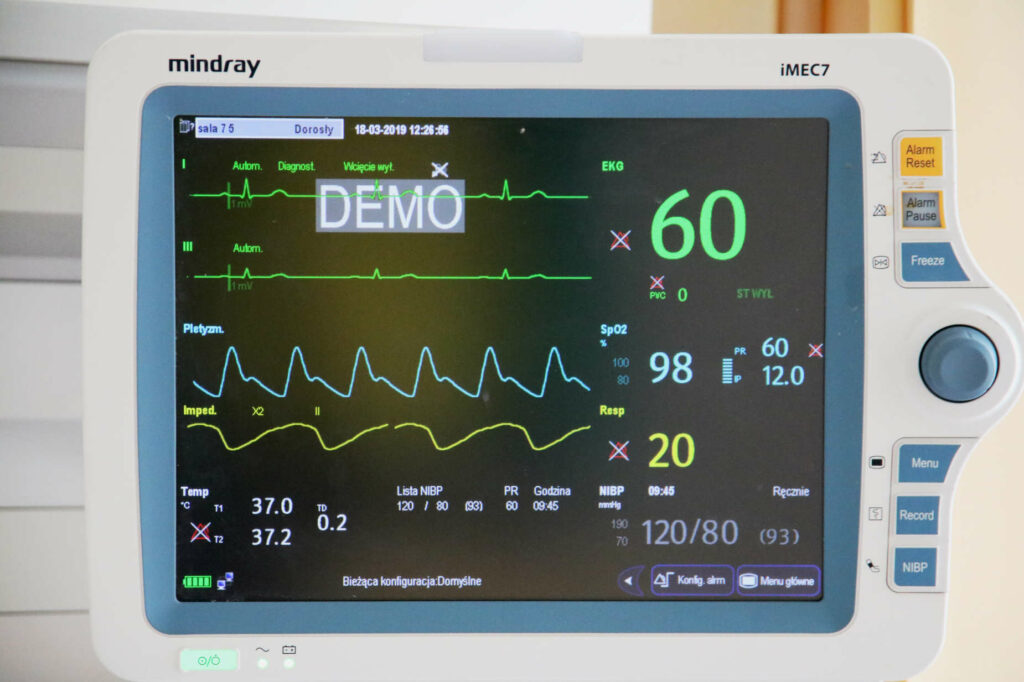 Nowe respiratory, kardiomonitory i mikroskop 3D. Ponad 10,5 mln zł dla szpitali marszałkowskich